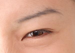 【2025年最新版】池袋で医療脱毛を選ぶなら知っておきたい完全ガイド